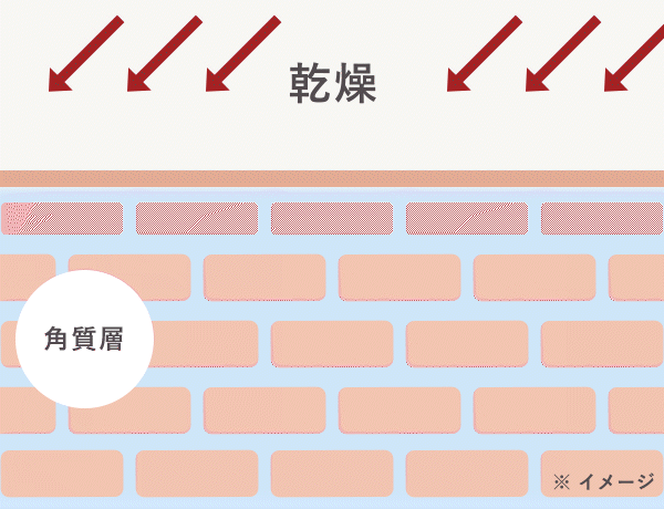 乾燥・ハリ不足のイメージ