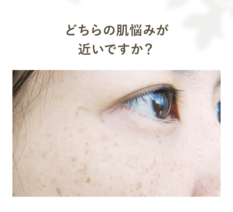 どちらの肌悩みが近いですか？