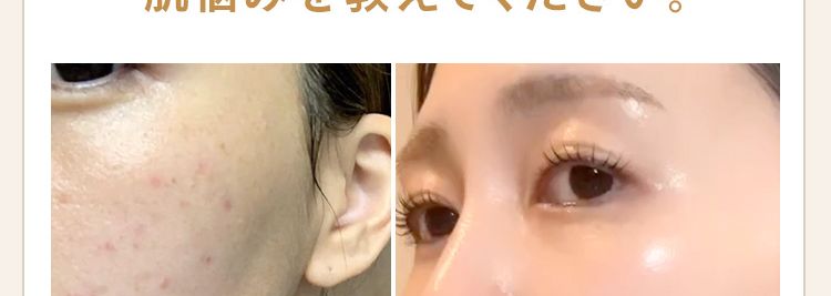 1 2
3 4
Q1
この時期、 気になる
肌悩みを教えてください。