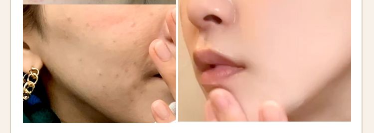 1 2
3 4
Q1
この時期、 気になる
肌悩みを教えてください。